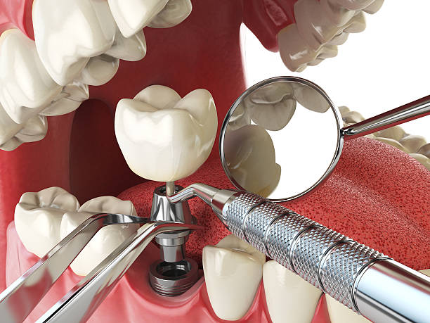 Best Pediatric Emergency Dentist in Bakersfield Country Clu, CA